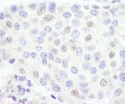 TFIIIC Antibody, Novus Biologicals 0.1mg; Unlabeled:Antibodies, Polyclonal